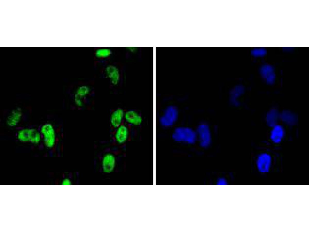 ICC staining of Cdk9 in Hela cells (green). Formalin fixed cells were permeabilized with 0.1% Triton X-100 in TBS for 10 minutes at room temperature and blocked with 1% Blocker BSA for 15 minutes at room temperature. Cells were probed with the primary antibody (ET1612-78, 1/50) for 1 hour at room temperature, washed with PBS. Alexa Fluor®488 Goat anti-Rabbit IgG was used as the secondary antibody at 1/1,000 dilution. The nuclear counter stain is DAPI (blue).