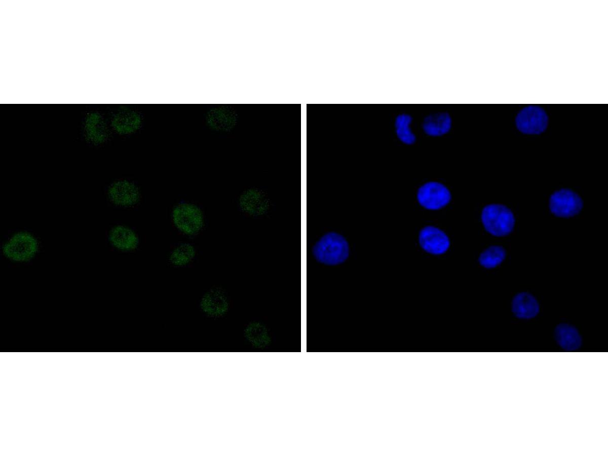 ICC staining of Cdk9 in A549 cells (green). Formalin fixed cells were permeabilized with 0.1% Triton X-100 in TBS for 10 minutes at room temperature and blocked with 1% Blocker BSA for 15 minutes at room temperature. Cells were probed with the primary antibody (ET1612-78, 1/50) for 1 hour at room temperature, washed with PBS. Alexa Fluor®488 Goat anti-Rabbit IgG was used as the secondary antibody at 1/1,000 dilution. The nuclear counter stain is DAPI (blue).