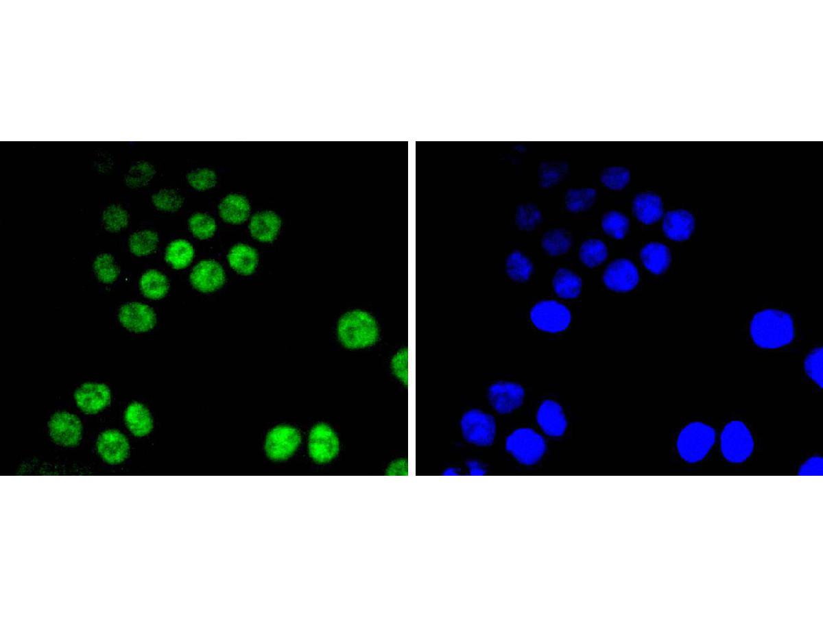 ICC staining of Cdk9 in SW480 cells (green). Formalin fixed cells were permeabilized with 0.1% Triton X-100 in TBS for 10 minutes at room temperature and blocked with 1% Blocker BSA for 15 minutes at room temperature. Cells were probed with the primary antibody (ET1612-78, 1/50) for 1 hour at room temperature, washed with PBS. Alexa Fluor®488 Goat anti-Rabbit IgG was used as the secondary antibody at 1/1,000 dilution. The nuclear counter stain is DAPI (blue).
