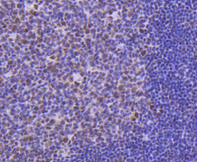 Immunohistochemical analysis of paraffin-embedded human tonsil tissue using anti-Cdk9 antibody. The section was pre-treated using heat mediated antigen retrieval with Tris-EDTA buffer (pH 8.0-8.4) for 20 minutes.The tissues were blocked in 5% BSA for 30 minutes at room temperature, washed with ddH2O and PBS, and then probed with the primary antibody (ET1612-78, 1/50) for 30 minutes at room temperature. The detection was performed using an HRP conjugated compact polymer system. DAB was used as the chromogen. Tissues were counterstained with hematoxylin and mounted with DPX.