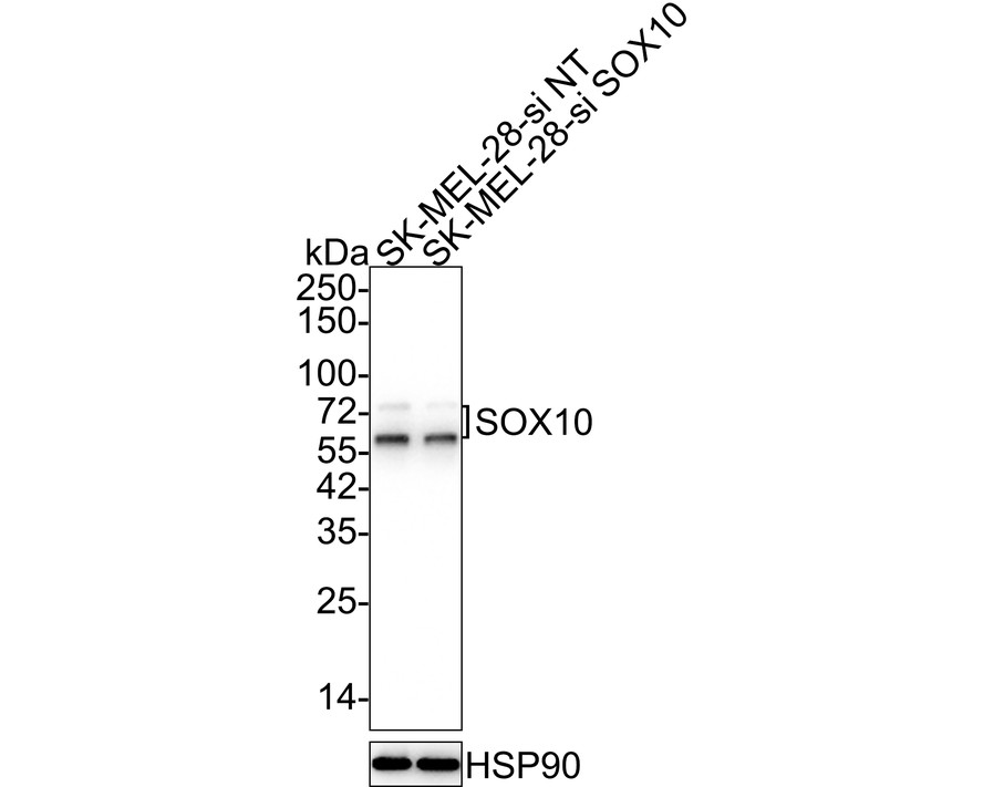 Immunohistochemical analysis of paraffin-embedded human skin tissue using anti-SOX10 antibody. The section was pre-treated using heat mediated antigen retrieval with sodium citrate buffer (pH 6.0) for 20 minutes. The tissues were blocked in 5% BSA for 30 minutes at room temperature, washed with ddH2O and PBS, and then probed with the primary antibody (ET1612-79, 1/50)  for 30 minutes at room temperature. The detection was performed using an HRP conjugated compact polymer system. DAB was used as the chromogen. Tissues were counterstained with hematoxylin and mounted with DPX.