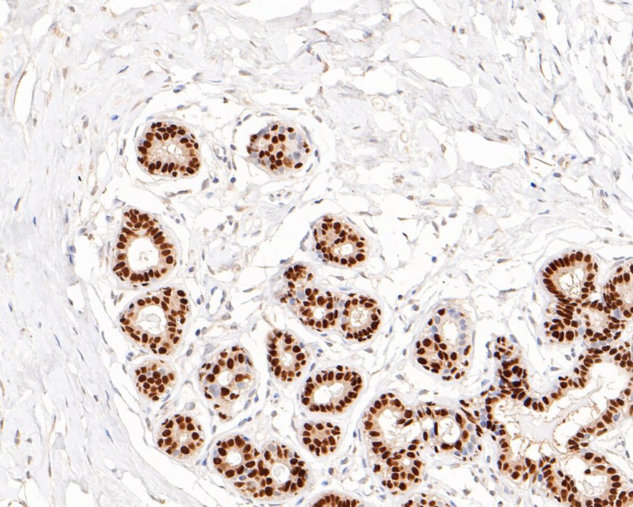 Immunohistochemical analysis of paraffin-embedded mouse brain tissue using anti-SOX10 antibody. The section was pre-treated using heat mediated antigen retrieval with sodium citrate buffer (pH 6.0) for 20 minutes. The tissues were blocked in 5% BSA for 30 minutes at room temperature, washed with ddH2O and PBS, and then probed with the primary antibody (ET1612-79, 1/50)  for 30 minutes at room temperature. The detection was performed using an HRP conjugated compact polymer system. DAB was used as the chromogen. Tissues were counterstained with hematoxylin and mounted with DPX.