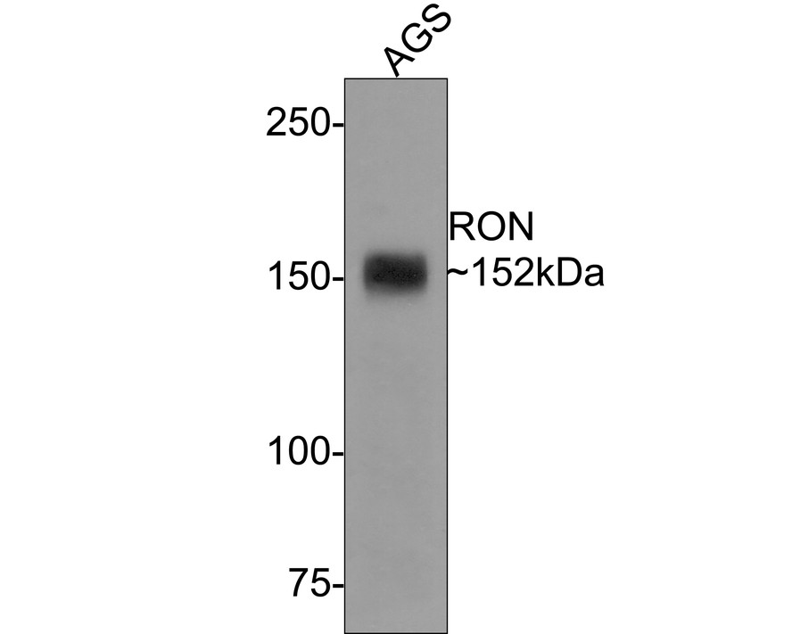 Western blot analysis of RON on AGS cell lysates with Rabbit anti-RON antibody (ET1612-80) at 1/500 dilution.<br />
<br />
Lysates/proteins at 10 µg/Lane.<br />
<br />
Predicted band size: 152 kDa<br />
Observed band size: 152 kDa<br />
<br />
Exposure time: 2 minutes;<br />
<br />
6% SDS-PAGE gel.<br />
<br />
Proteins were transferred to a PVDF membrane and blocked with 5% NFDM/TBST for 1 hour at room temperature. The primary antibody (ET1612-80) at 1/500 dilution was used in 5% NFDM/TBST at room temperature for 2 hours. Goat Anti-Rabbit IgG - HRP Secondary Antibody (HA1001) at 1:300,000 dilution was used for 1 hour at room temperature.
