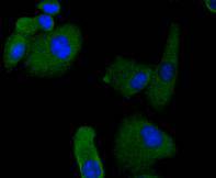ICC staining of RON in A549 cells (green). Formalin fixed cells were permeabilized with 0.1% Triton X-100 in TBS for 10 minutes at room temperature and blocked with 1% Blocker BSA for 15 minutes at room temperature. Cells were probed with the primary antibody (ET1612-80, 1/50) for 1 hour at room temperature, washed with PBS. Alexa Fluor®488 Goat anti-Rabbit IgG was used as the secondary antibody at 1/1,000 dilution. The nuclear counter stain is DAPI (blue).