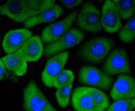 ICC staining of RON in AGS cells (green). Formalin fixed cells were permeabilized with 0.1% Triton X-100 in TBS for 10 minutes at room temperature and blocked with 1% Blocker BSA for 15 minutes at room temperature. Cells were probed with the primary antibody (ET1612-80, 1/50) for 1 hour at room temperature, washed with PBS. Alexa Fluor®488 Goat anti-Rabbit IgG was used as the secondary antibody at 1/1,000 dilution. The nuclear counter stain is DAPI (blue).