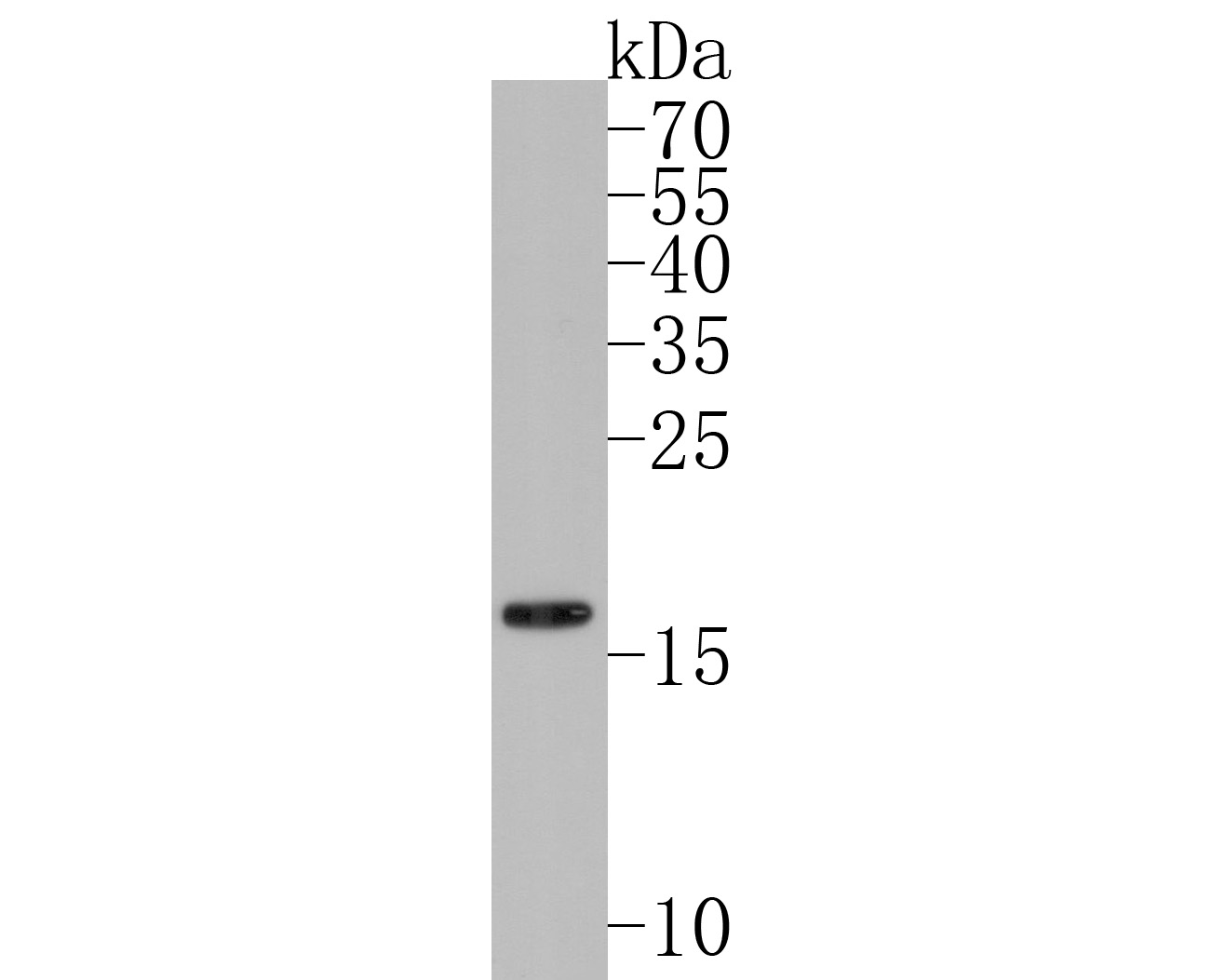 Western blot analysis of Hsp20 on rat skeletal muscle tissue lysates. Proteins were transferred to a PVDF membrane and blocked with 5% BSA in PBS for 1 hour at room temperature. The primary antibody (ET1612-81, 1/500) was used in 5% BSA at room temperature for 2 hours. Goat Anti-Rabbit IgG - HRP Secondary Antibody (HA1001) at 1:200,000 dilution was used for 1 hour at room temperature.