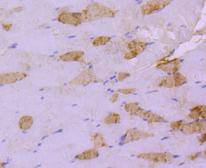 Immunohistochemical analysis of paraffin-embedded mouse skeletal muscle tissue using anti-Hsp20 antibody. The section was pre-treated using heat mediated antigen retrieval with Tris-EDTA buffer (pH 8.0-8.4) for 20 minutes.The tissues were blocked in 5% BSA for 30 minutes at room temperature, washed with ddH2O and PBS, and then probed with the primary antibody (ET1612-81, 1/50) for 30 minutes at room temperature. The detection was performed using an HRP conjugated compact polymer system. DAB was used as the chromogen. Tissues were counterstained with hematoxylin and mounted with DPX.