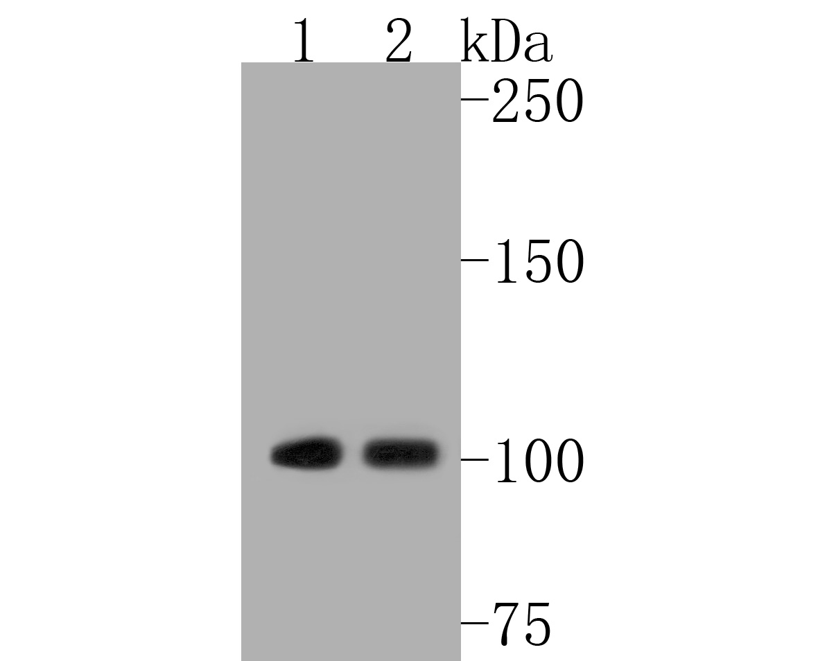 Western blot analysis of Ubiquitin-like modifier-activating enzyme 1 on different lysates. Proteins were transferred to a PVDF membrane and blocked with 5% BSA in PBS for 1 hour at room temperature. The primary antibody (ET1612-82, 1/500) was used in 5% BSA at room temperature for 2 hours. Goat Anti-Rabbit IgG - HRP Secondary Antibody (HA1001) at 1:5,000 dilution was used for 1 hour at room temperature.<br />
Positive control: <br />
Lane 1: Mouse kidney tissue lysate<br />
Lane 2: Mouse liver tissue lysate
