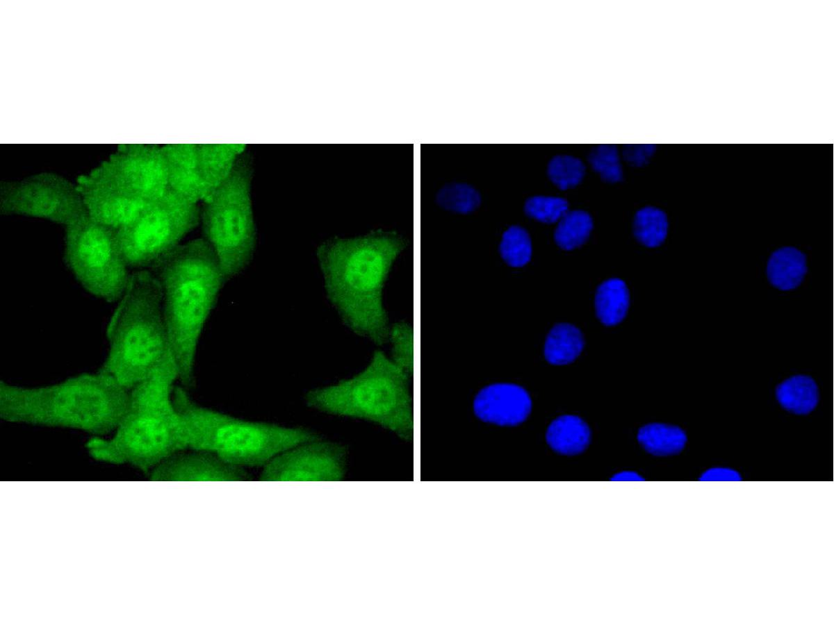 ICC staining of Ubiquitin-like modifier-activating enzyme 1 in SKOV-3 cells (green). Formalin fixed cells were permeabilized with 0.1% Triton X-100 in TBS for 10 minutes at room temperature and blocked with 1% Blocker BSA for 15 minutes at room temperature. Cells were probed with the primary antibody (ET1612-82, 1/50) for 1 hour at room temperature, washed with PBS. Alexa Fluor®488 Goat anti-Rabbit IgG was used as the secondary antibody at 1/1,000 dilution. The nuclear counter stain is DAPI (blue).
