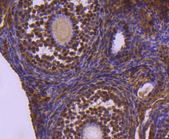 Immunohistochemical analysis of paraffin-embedded mouse ovary tissue using anti-Ubiquitin-like modifier-activating enzyme 1 antibody. The section was pre-treated using heat mediated antigen retrieval with Tris-EDTA buffer (pH 8.0-8.4) for 20 minutes.The tissues were blocked in 5% BSA for 30 minutes at room temperature, washed with ddH2O and PBS, and then probed with the primary antibody (ET1612-82, 1/50) for 30 minutes at room temperature. The detection was performed using an HRP conjugated compact polymer system. DAB was used as the chromogen. Tissues were counterstained with hematoxylin and mounted with DPX.