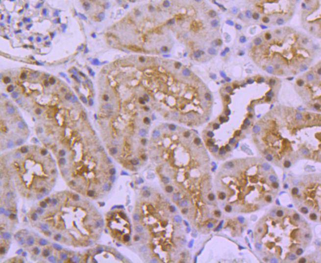 Immunohistochemical analysis of paraffin-embedded human kidney tissue using anti-Ubiquitin-like modifier-activating enzyme 1 antibody. The section was pre-treated using heat mediated antigen retrieval with Tris-EDTA buffer (pH 8.0-8.4) for 20 minutes.The tissues were blocked in 5% BSA for 30 minutes at room temperature, washed with ddH2O and PBS, and then probed with the primary antibody (ET1612-82, 1/50) for 30 minutes at room temperature. The detection was performed using an HRP conjugated compact polymer system. DAB was used as the chromogen. Tissues were counterstained with hematoxylin and mounted with DPX.