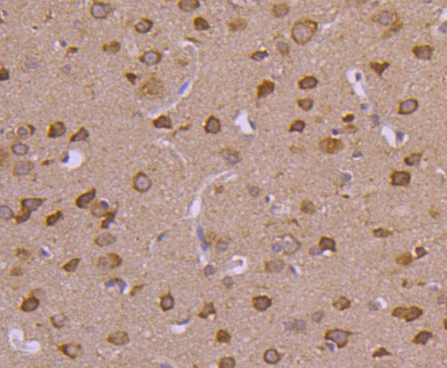 Immunohistochemical analysis of paraffin-embedded rat brain tissue using anti-HSPA4 antibody. The section was pre-treated using heat mediated antigen retrieval with Tris-EDTA buffer (pH 8.0-8.4) for 20 minutes.The tissues were blocked in 5% BSA for 30 minutes at room temperature, washed with ddH2O and PBS, and then probed with the primary antibody (ET1612-83, 1/50) for 30 minutes at room temperature. The detection was performed using an HRP conjugated compact polymer system. DAB was used as the chromogen. Tissues were counterstained with hematoxylin and mounted with DPX.