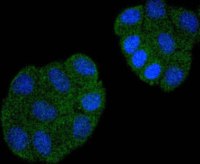 ICC staining of CDC23 in HepG2 cells (green). Formalin fixed cells were permeabilized with 0.1% Triton X-100 in TBS for 10 minutes at room temperature and blocked with 1% Blocker BSA for 15 minutes at room temperature. Cells were probed with the primary antibody (ET1612-84, 1/50) for 1 hour at room temperature, washed with PBS. Alexa Fluor®488 Goat anti-Rabbit IgG was used as the secondary antibody at 1/1,000 dilution. The nuclear counter stain is DAPI (blue).