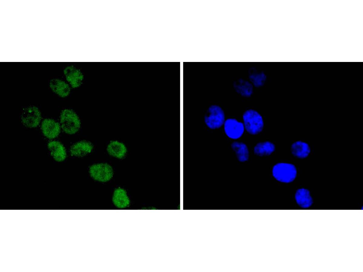 ICC staining CDC40 in Hela cells (green). The nuclear counter stain is DAPI (blue). Cells were fixed in paraformaldehyde, permeabilised with 0.25% Triton X100/PBS.
