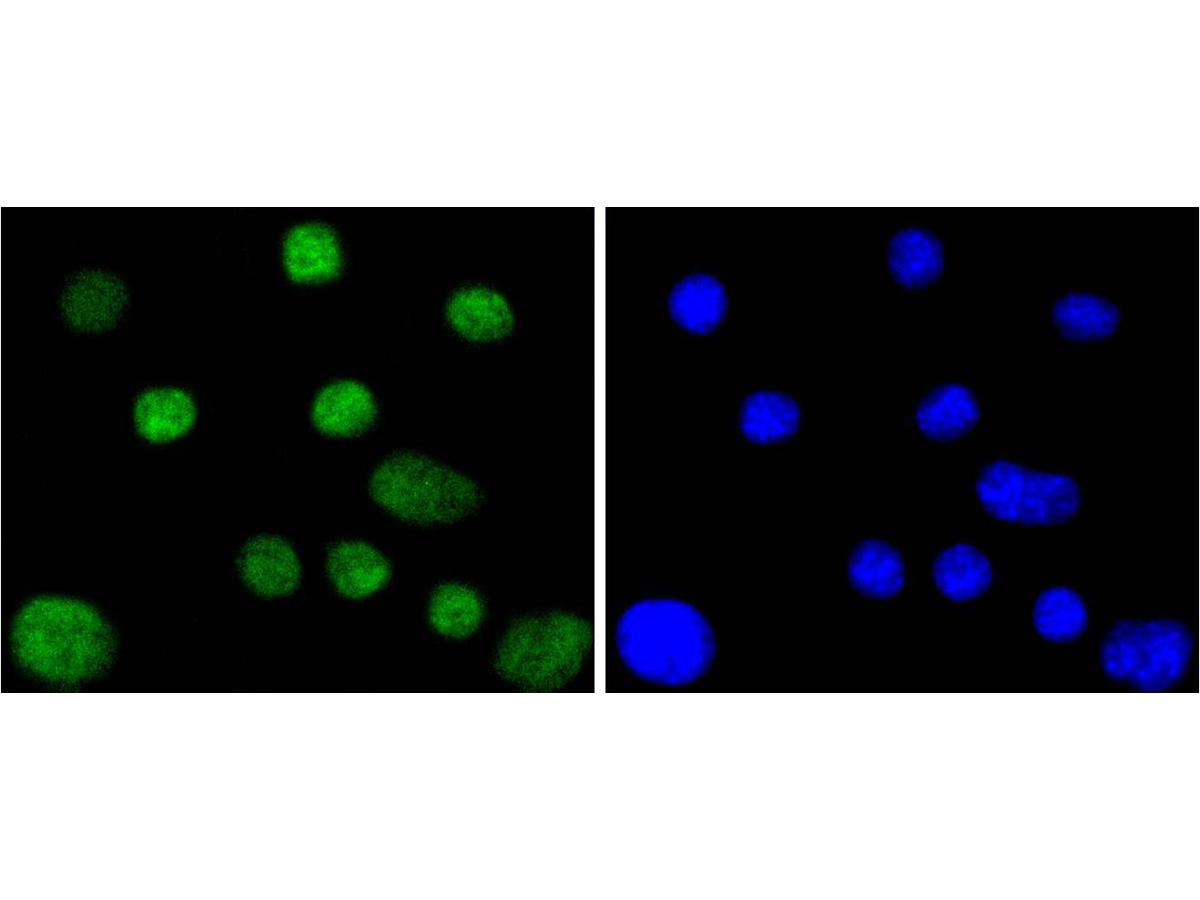 ICC staining CDC40 in SHG-44 cells (green). The nuclear counter stain is DAPI (blue). Cells were fixed in paraformaldehyde, permeabilised with 0.25% Triton X100/PBS.