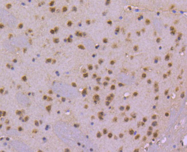 Immunohistochemical analysis of paraffin-embedded mouse brain tissue using anti-CDC40 antibody. Counter stained with hematoxylin.