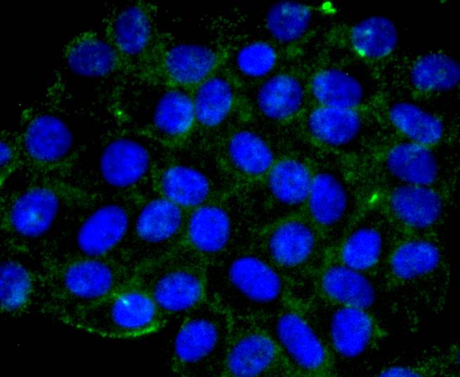 ICC staining APC6 in HepG2 cells (green). The nuclear counter stain is DAPI (blue). Cells were fixed in paraformaldehyde, permeabilised with 0.25% Triton X100/PBS.