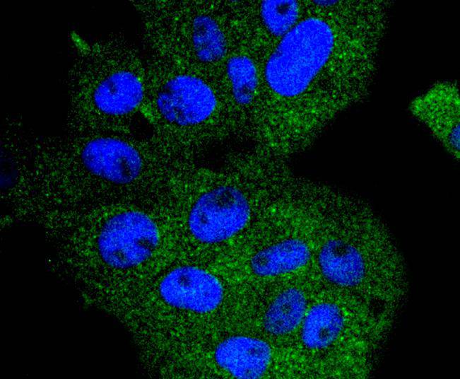 ICC staining APC6 in RH-35 cells (green). The nuclear counter stain is DAPI (blue). Cells were fixed in paraformaldehyde, permeabilised with 0.25% Triton X100/PBS.