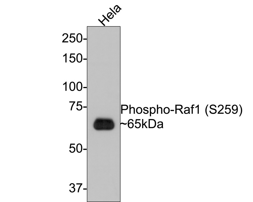 Western blot analysis of Phospho-Raf1 (S259) on Hela cell lysates with Rabbit anti-Phospho-Raf1 (S259) antibody (ET1612-87) at 1/500 dilution.<br />
<br />
Lysates/proteins at 10 µg/Lane.<br />
<br />
Predicted band size: 73 kDa<br />
Observed band size: 65 kDa<br />
<br />
Exposure time: 1 minute;<br />
<br />
8% SDS-PAGE gel.<br />
<br />
Proteins were transferred to a PVDF membrane and blocked with 5% NFDM/TBST for 1 hour at room temperature. The primary antibody (ET1612-87) at 1/500 dilution was used in 5% NFDM/TBST at room temperature for 2 hours. Goat Anti-Rabbit IgG - HRP Secondary Antibody (HA1001) at 1:300,000 dilution was used for 1 hour at room temperature.