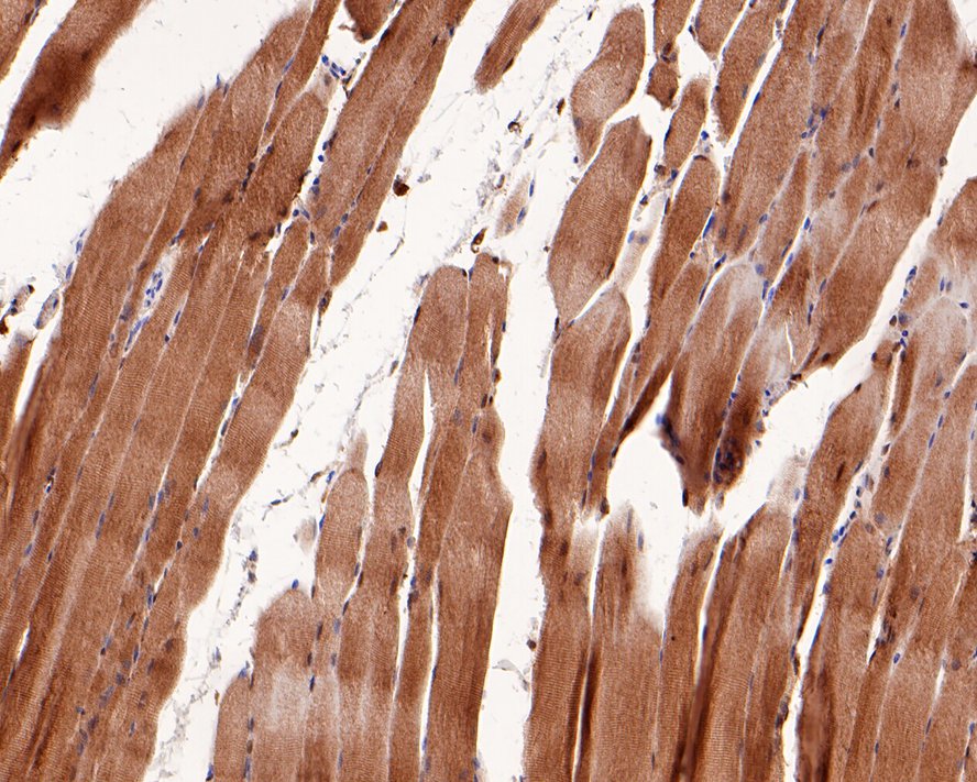 Immunohistochemical analysis of paraffin-embedded rat skeletal muscle tissue with Rabbit anti-Phospho-Raf1 (S259) antibody (ET1612-87) at 1/500 dilution.<br />
<br />
The section was pre-treated using heat mediated antigen retrieval with sodium citrate buffer (pH 6.0) for 2 minutes. The tissues were blocked in 1% BSA for 20 minutes at room temperature, washed with ddH2O and PBS, and then probed with the primary antibody (ET1612-87) at 1/500 dilution for 1 hour at room temperature. The detection was performed using an HRP conjugated compact polymer system. DAB was used as the chromogen. Tissues were counterstained with hematoxylin and mounted with DPX.