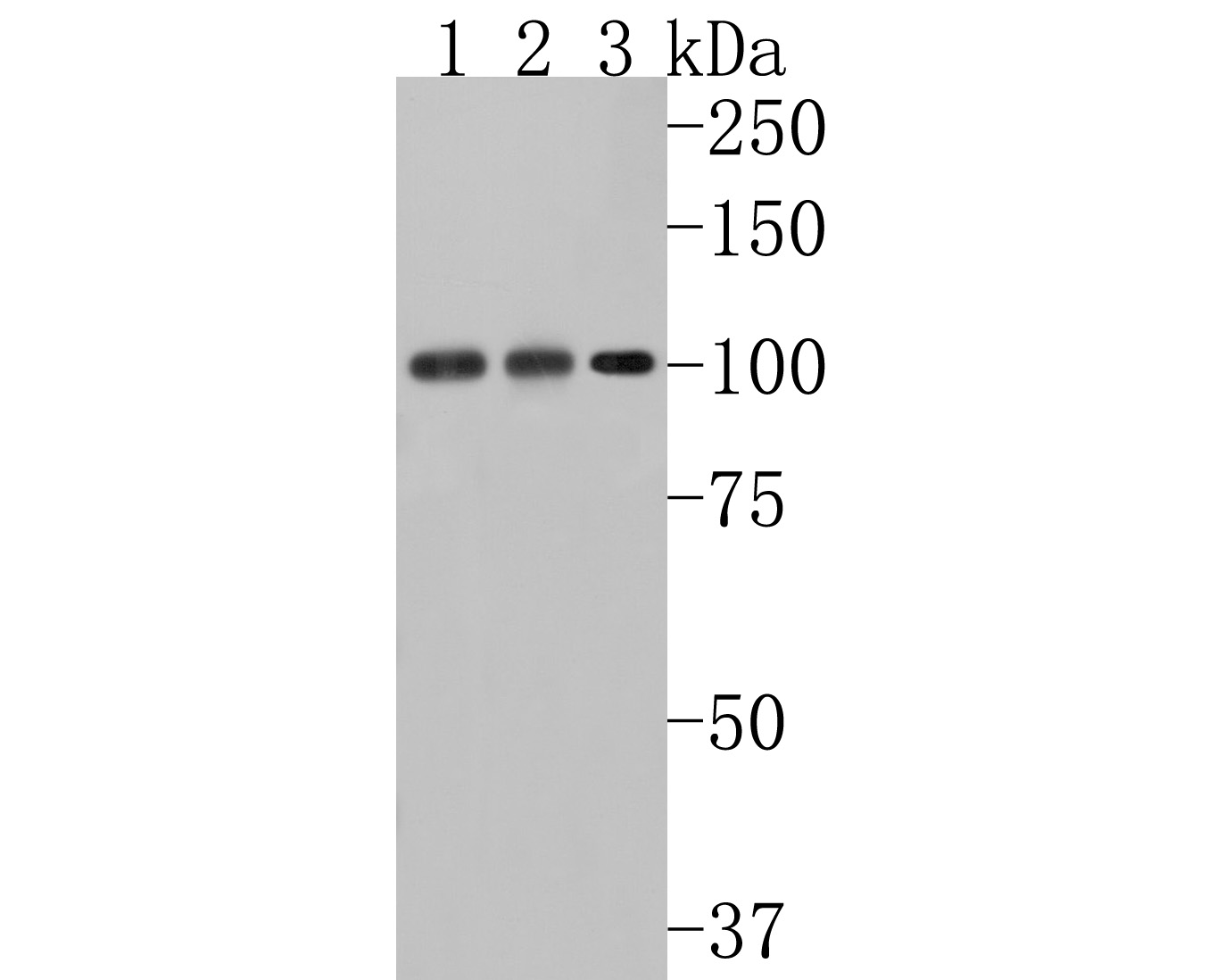 Western blot analysis of Hsp105 on different lysates. Proteins were transferred to a PVDF membrane and blocked with 5% BSA in PBS for 1 hour at room temperature. The primary antibody (ET1612-88, 1/500) was used in 5% BSA at room temperature for 2 hours. Goat Anti-Rabbit IgG - HRP Secondary Antibody (HA1001) at 1:200,000 dilution was used for 1 hour at room temperature.<br />
Positive control: <br />
Lane 1: MCF-7 cell lysate<br />
Lane 2: Hela cell lysate<br />
Lane 3: Daudi cell lysate