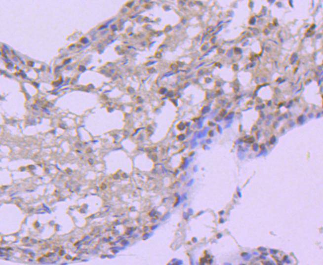 Immunohistochemical analysis of paraffin-embedded rat testis tissue using anti-Hsp105 antibody. The section was pre-treated using heat mediated antigen retrieval with Tris-EDTA buffer (pH 9.0) for 20 minutes.The tissues were blocked in 1% BSA for 30 minutes at room temperature, washed with ddH2O and PBS, and then probed with the primary antibody (ET1612-88, 1/50) for 30 minutes at room temperature. The detection was performed using an HRP conjugated compact polymer system. DAB was used as the chromogen. Tissues were counterstained with hematoxylin and mounted with DPX.
