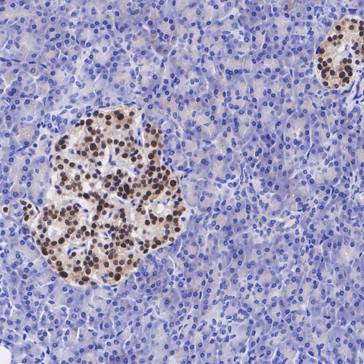 Immunohistochemical analysis of paraffin-embedded rat eyeball tissue using anti-PAX6 antibody. The section was pre-treated using heat mediated antigen retrieval with Tris-EDTA buffer (pH 8.0-8.4) for 20 minutes.The tissues were blocked in 5% BSA for 30 minutes at room temperature, washed with ddH2O and PBS, and then probed with the primary antibody (ET1612-89, 1/50) for 30 minutes at room temperature. The detection was performed using an HRP conjugated compact polymer system. DAB was used as the chromogen. Tissues were counterstained with hematoxylin and mounted with DPX.