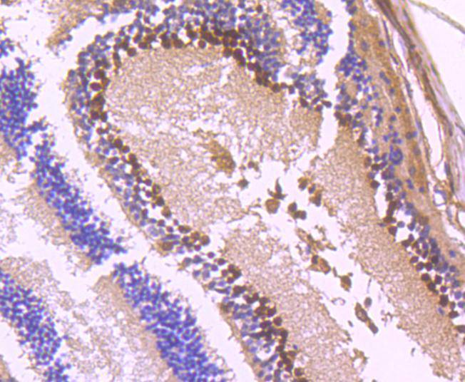 Immunohistochemical analysis of paraffin-embedded mouse eyeball tissue using anti-PAX6 antibody. The section was pre-treated using heat mediated antigen retrieval with Tris-EDTA buffer (pH 8.0-8.4) for 20 minutes.The tissues were blocked in 5% BSA for 30 minutes at room temperature, washed with ddH2O and PBS, and then probed with the primary antibody (ET1612-89, 1/50) for 30 minutes at room temperature. The detection was performed using an HRP conjugated compact polymer system. DAB was used as the chromogen. Tissues were counterstained with hematoxylin and mounted with DPX.
