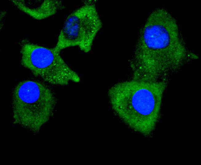 ICC staining of Collagen VI in HepG2 cells (green). Formalin fixed cells were permeabilized with 0.1% Triton X-100 in TBS for 10 minutes at room temperature and blocked with 10% negative goat serum for 15 minutes at room temperature. Cells were probed with the primary antibody (ET1612-91, 1/50) for 1 hour at room temperature, washed with PBS. Alexa Fluor®488 conjugate-Goat anti-Rabbit IgG was used as the secondary antibody at 1/1,000 dilution. The nuclear counter stain is DAPI (blue).