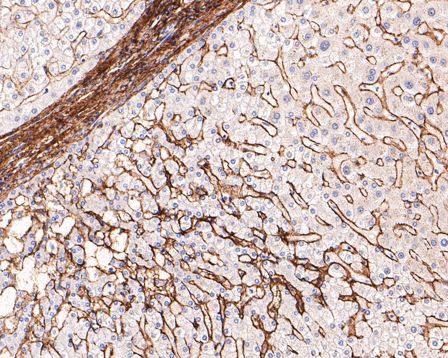 Immunohistochemical analysis of paraffin-embedded mouse colon tissue using anti-Collagen VI antibody. The section was pre-treated using heat mediated antigen retrieval with Tris-EDTA buffer (pH 9.0) for 20 minutes.The tissues were blocked in 1% BSA for 30 minutes at room temperature, washed with ddH2O and PBS, and then probed with the primary antibody (ET1612-91, 1/50) for 30 minutes at room temperature. The detection was performed using an HRP conjugated compact polymer system. DAB was used as the chromogen. Tissues were counterstained with hematoxylin and mounted with DPX.