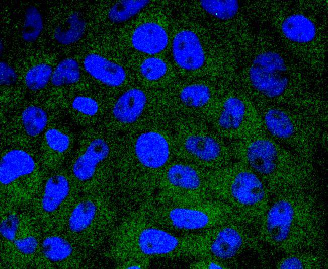 ICC staining of HSPA14 in RH-35 cells (green). Formalin fixed cells were permeabilized with 0.1% Triton X-100 in TBS for 10 minutes at room temperature and blocked with 10% negative goat serum for 15 minutes at room temperature. Cells were probed with the primary antibody (ET1612-93, 1/50) for 1 hour at room temperature, washed with PBS. Alexa Fluor®488 conjugate-Goat anti-Rabbit IgG was used as the secondary antibody at 1/1,000 dilution. The nuclear counter stain is DAPI (blue).