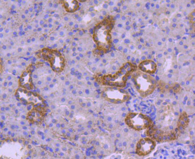 Immunohistochemical analysis of paraffin-embedded rat kidney tissue using anti-HSPA14 antibody. The section was pre-treated using heat mediated antigen retrieval with Tris-EDTA buffer (pH 9.0) for 20 minutes.The tissues were blocked in 1% BSA for 30 minutes at room temperature, washed with ddH2O and PBS, and then probed with the primary antibody (ET1612-93, 1/50) for 30 minutes at room temperature. The detection was performed using an HRP conjugated compact polymer system. DAB was used as the chromogen. Tissues were counterstained with hematoxylin and mounted with DPX.