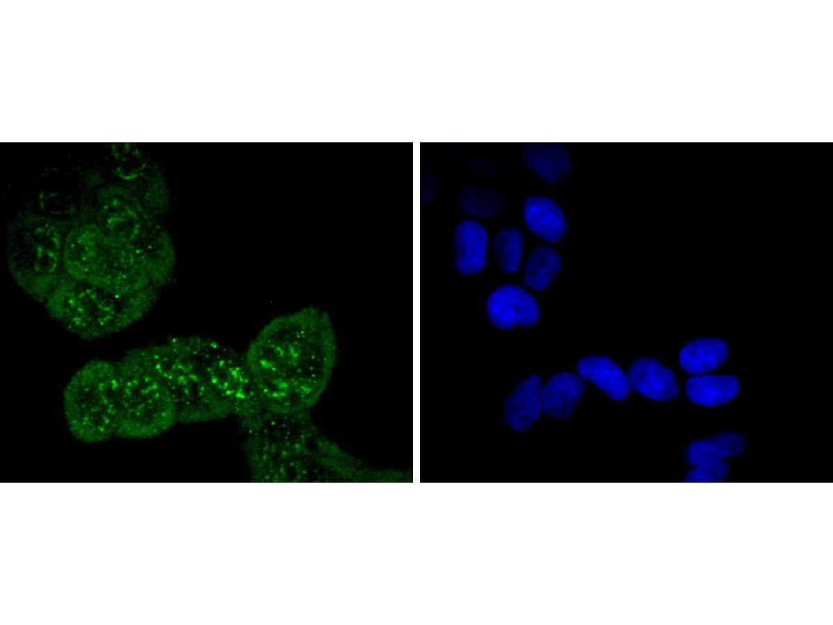ICC staining of Phospho-Cdc6 (S54) in Hela cells (green). Formalin fixed cells were permeabilized with 0.1% Triton X-100 in TBS for 10 minutes at room temperature and blocked with 1% Blocker BSA for 15 minutes at room temperature. Cells were probed with the primary antibody (ET1612-96, 1/50) for 1 hour at room temperature, washed with PBS. Alexa Fluor®488 Goat anti-Rabbit IgG was used as the secondary antibody at 1/1,000 dilution. The nuclear counter stain is DAPI (blue).