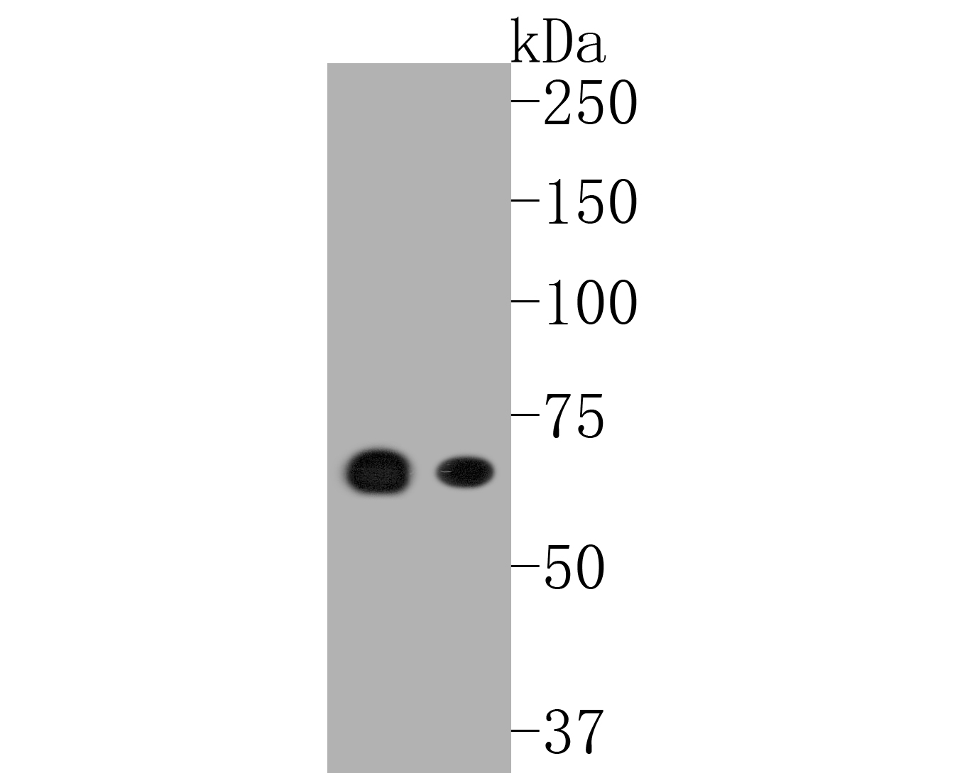 Western blot analysis of MEKK3 on different lysates. Proteins were transferred to a PVDF membrane and blocked with 5% BSA in PBS for 1 hour at room temperature. The primary antibody (ET1612-98, 1/500) was used in 5% BSA at room temperature for 2 hours. Goat Anti-Rabbit IgG - HRP Secondary Antibody (HA1001) at 1:5,000 dilution was used for 1 hour at room temperature.<br />
Positive control: <br />
Lane 1: 293T cell lysate<br />
Lane 2: A431 cell lysate