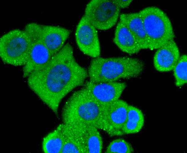 ICC staining of MEKK3 in MCF-7 cells (green). Formalin fixed cells were permeabilized with 0.1% Triton X-100 in TBS for 10 minutes at room temperature and blocked with 1% Blocker BSA for 15 minutes at room temperature. Cells were probed with the primary antibody (ET1612-98, 1/50) for 1 hour at room temperature, washed with PBS. Alexa Fluor®488 Goat anti-Rabbit IgG was used as the secondary antibody at 1/1,000 dilution. The nuclear counter stain is DAPI (blue).