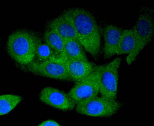 ICC staining of MEKK3 in SKOV-3 cells (green). Formalin fixed cells were permeabilized with 0.1% Triton X-100 in TBS for 10 minutes at room temperature and blocked with 1% Blocker BSA for 15 minutes at room temperature. Cells were probed with the primary antibody (ET1612-98, 1/50) for 1 hour at room temperature, washed with PBS. Alexa Fluor®488 Goat anti-Rabbit IgG was used as the secondary antibody at 1/1,000 dilution. The nuclear counter stain is DAPI (blue).