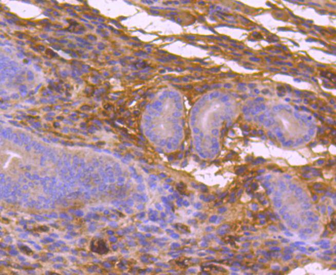 Immunohistochemical analysis of paraffin-embedded mouse uterus tissue using anti-MEKK3 antibody. The section was pre-treated using heat mediated antigen retrieval with Tris-EDTA buffer (pH 8.0-8.4) for 20 minutes.The tissues were blocked in 5% BSA for 30 minutes at room temperature, washed with ddH2O and PBS, and then probed with the primary antibody (ET1612-98, 1/50) for 30 minutes at room temperature. The detection was performed using an HRP conjugated compact polymer system. DAB was used as the chromogen. Tissues were counterstained with hematoxylin and mounted with DPX.