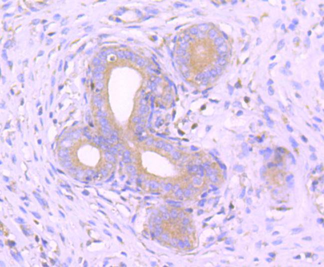 Immunohistochemical analysis of paraffin-embedded rat uterus tissue using anti-MEKK3 antibody. The section was pre-treated using heat mediated antigen retrieval with Tris-EDTA buffer (pH 8.0-8.4) for 20 minutes.The tissues were blocked in 5% BSA for 30 minutes at room temperature, washed with ddH2O and PBS, and then probed with the primary antibody (ET1612-98, 1/50) for 30 minutes at room temperature. The detection was performed using an HRP conjugated compact polymer system. DAB was used as the chromogen. Tissues were counterstained with hematoxylin and mounted with DPX.