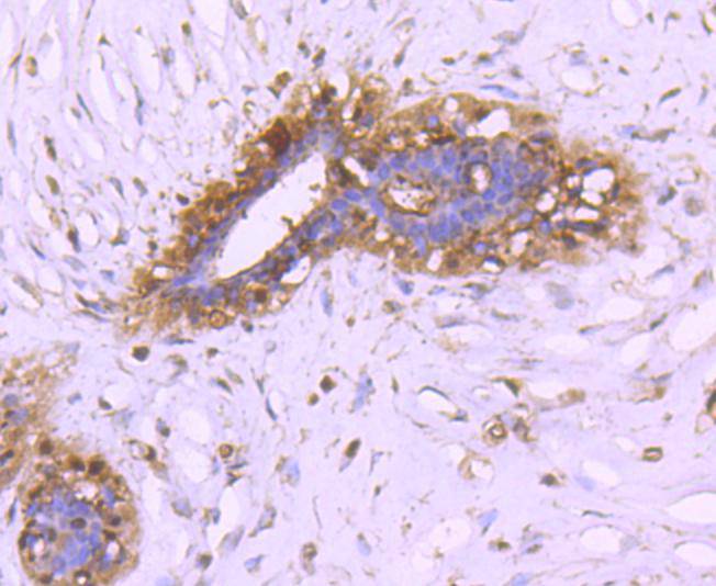 Immunohistochemical analysis of paraffin-embedded human breast tissue using anti-14-3-3 alpha+beta antibody. The section was pre-treated using heat mediated antigen retrieval with Tris-EDTA buffer (pH 8.0-8.4) for 20 minutes.The tissues were blocked in 5% BSA for 30 minutes at room temperature, washed with ddH2O and PBS, and then probed with the primary antibody (ET1612-99, 1/50) for 30 minutes at room temperature. The detection was performed using an HRP conjugated compact polymer system. DAB was used as the chromogen. Tissues were counterstained with hematoxylin and mounted with DPX.