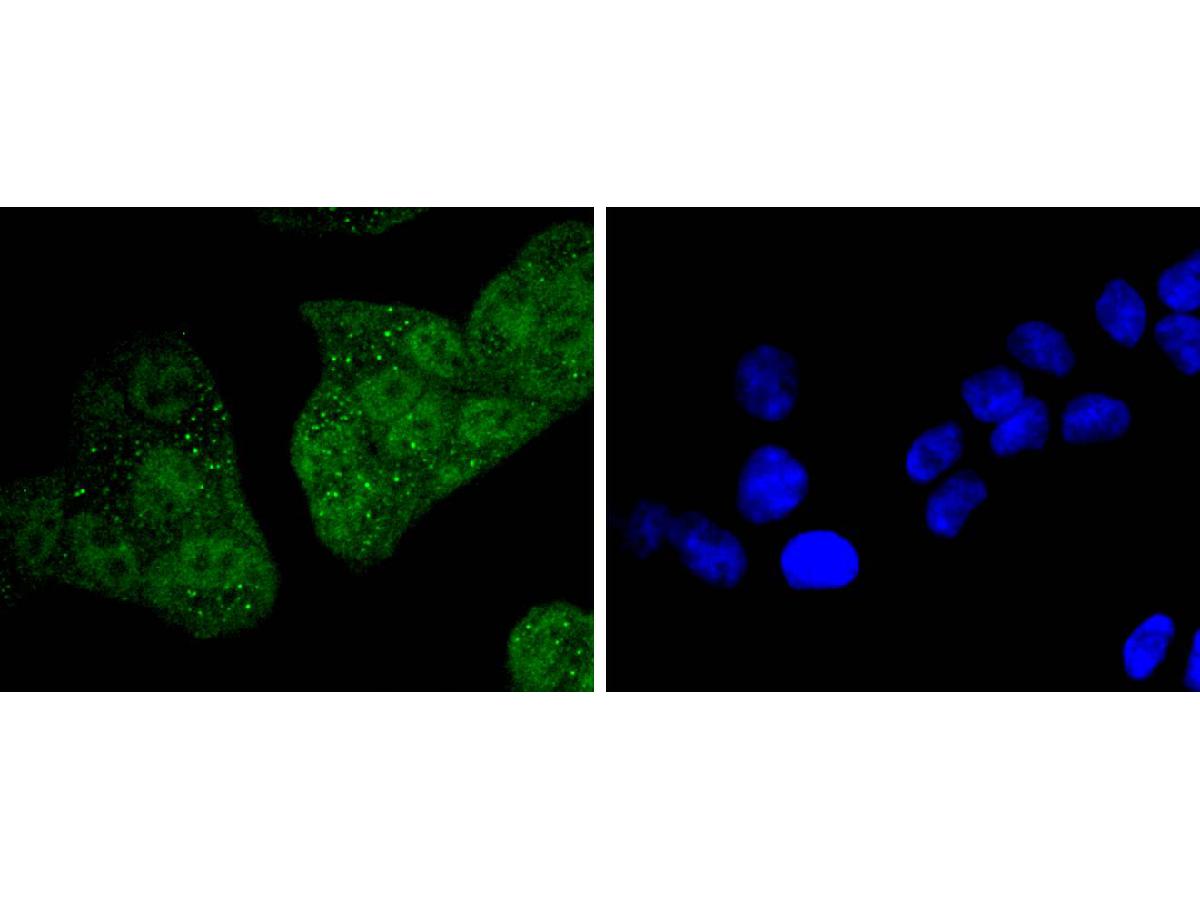 ICC staining of 14-3-3 epsilon in Hela cells (green). Formalin fixed cells were permeabilized with 0.1% Triton X-100 in TBS for 10 minutes at room temperature and blocked with 10% negative goat serum for 15 minutes at room temperature. Cells were probed with the primary antibody (ET1701-1, 1/50) for 1 hour at room temperature, washed with PBS. Alexa Fluor®488 conjugate-Goat anti-Rabbit IgG was used as the secondary antibody at 1/1,000 dilution. The nuclear counter stain is DAPI (blue).