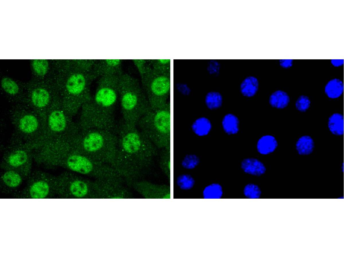 ICC staining of 14-3-3 epsilon in NIH/3T3 cells (green). Formalin fixed cells were permeabilized with 0.1% Triton X-100 in TBS for 10 minutes at room temperature and blocked with 10% negative goat serum for 15 minutes at room temperature. Cells were probed with the primary antibody (ET1701-1, 1/50) for 1 hour at room temperature, washed with PBS. Alexa Fluor®488 conjugate-Goat anti-Rabbit IgG was used as the secondary antibody at 1/1,000 dilution. The nuclear counter stain is DAPI (blue).