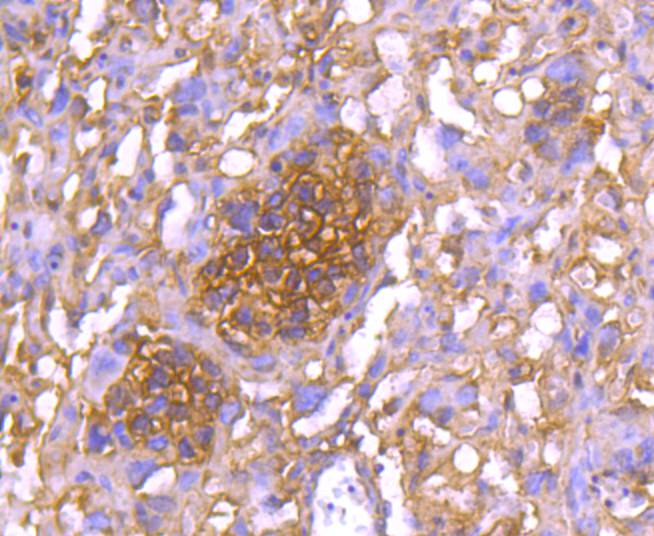 Immunohistochemical analysis of paraffin-embedded mouse placenta tissue using anti-14-3-3 epsilon antibody. The section was pre-treated using heat mediated antigen retrieval with Tris-EDTA buffer (pH 9.0) for 20 minutes.The tissues were blocked in 1% BSA for 30 minutes at room temperature, washed with ddH2O and PBS, and then probed with the primary antibody (ET1701-1, 1/50) for 30 minutes at room temperature. The detection was performed using an HRP conjugated compact polymer system. DAB was used as the chromogen. Tissues were counterstained with hematoxylin and mounted with DPX.