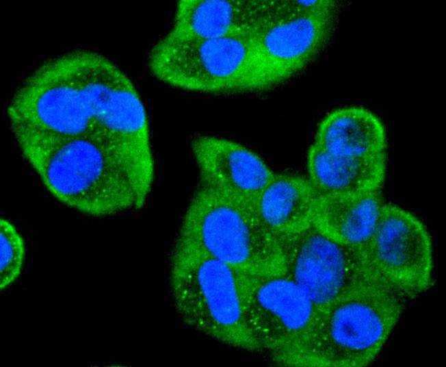 ICC staining of Cdc34 in Hela cells (green). Formalin fixed cells were permeabilized with 0.1% Triton X-100 in TBS for 10 minutes at room temperature and blocked with 10% negative goat serum for 15 minutes at room temperature. Cells were probed with the primary antibody (ET1701-10, 1/50) for 1 hour at room temperature, washed with PBS. Alexa Fluor®488 conjugate-Goat anti-Rabbit IgG was used as the secondary antibody at 1/1,000 dilution. The nuclear counter stain is DAPI (blue).