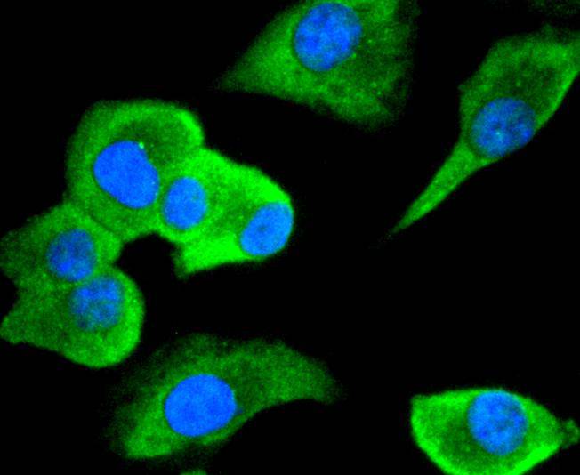 ICC staining of Cdc34 in A549 cells (green). Formalin fixed cells were permeabilized with 0.1% Triton X-100 in TBS for 10 minutes at room temperature and blocked with 10% negative goat serum for 15 minutes at room temperature. Cells were probed with the primary antibody (ET1701-10, 1/50) for 1 hour at room temperature, washed with PBS. Alexa Fluor®488 conjugate-Goat anti-Rabbit IgG was used as the secondary antibody at 1/1,000 dilution. The nuclear counter stain is DAPI (blue).