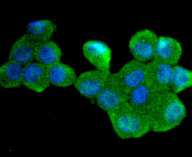 ICC staining of Cdc34 in N2A cells (green). Formalin fixed cells were permeabilized with 0.1% Triton X-100 in TBS for 10 minutes at room temperature and blocked with 10% negative goat serum for 15 minutes at room temperature. Cells were probed with the primary antibody (ET1701-10, 1/50) for 1 hour at room temperature, washed with PBS. Alexa Fluor®488 conjugate-Goat anti-Rabbit IgG was used as the secondary antibody at 1/1,000 dilution. The nuclear counter stain is DAPI (blue).