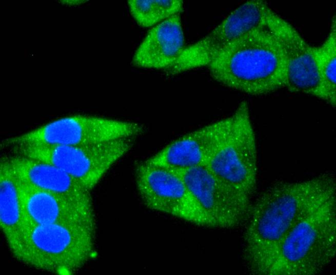 ICC staining of Hsp22 in Hela cells (green). Formalin fixed cells were permeabilized with 0.1% Triton X-100 in TBS for 10 minutes at room temperature and blocked with 1% Blocker BSA for 15 minutes at room temperature. Cells were probed with the primary antibody (ET1701-11, 1/50) for 1 hour at room temperature, washed with PBS. Alexa Fluor®488 Goat anti-Rabbit IgG was used as the secondary antibody at 1/1,000 dilution. The nuclear counter stain is DAPI (blue).