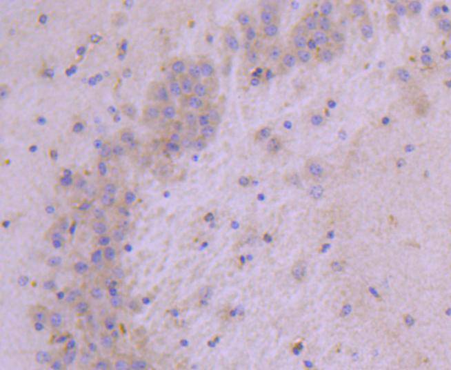 Immunohistochemical analysis of paraffin-embedded mouse brain tissue using anti-Hsp22 antibody. The section was pre-treated using heat mediated antigen retrieval with Tris-EDTA buffer (pH 8.0-8.4) for 20 minutes.The tissues were blocked in 5% BSA for 30 minutes at room temperature, washed with ddH2O and PBS, and then probed with the primary antibody (ET1701-11, 1/50) for 30 minutes at room temperature. The detection was performed using an HRP conjugated compact polymer system. DAB was used as the chromogen. Tissues were counterstained with hematoxylin and mounted with DPX.