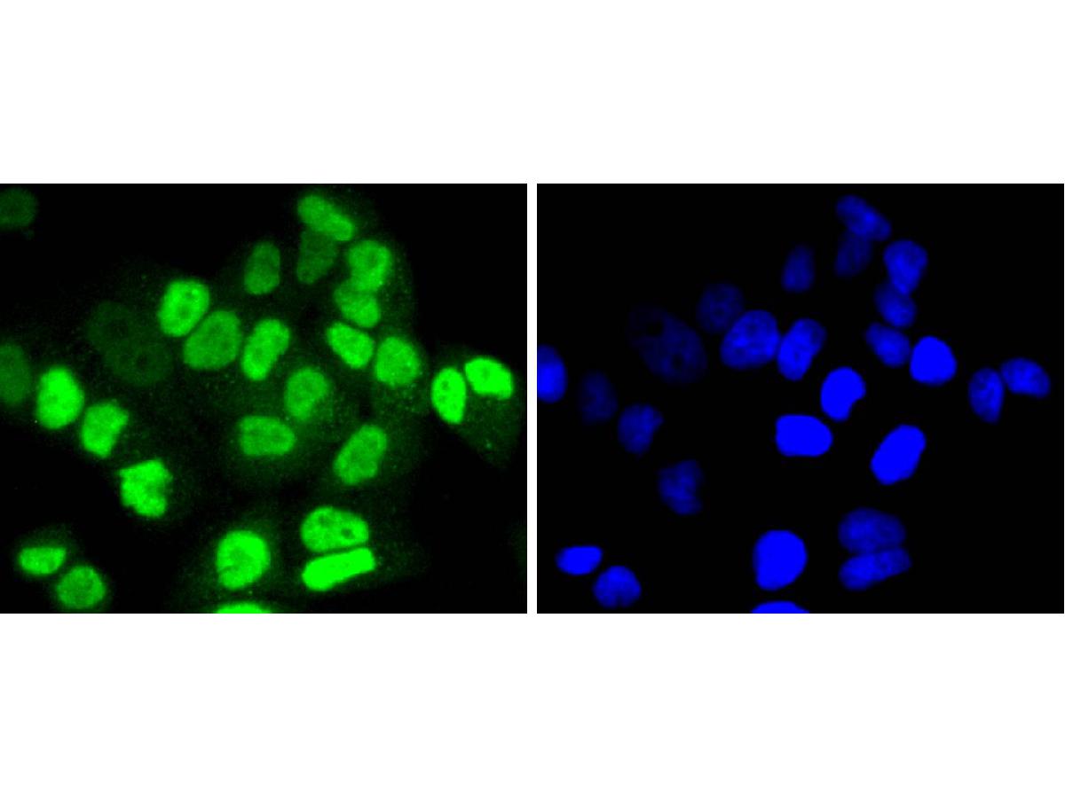 ICC staining of HDAC8 in Hela cells (green). Formalin fixed cells were permeabilized with 0.1% Triton X-100 in TBS for 10 minutes at room temperature and blocked with 1% Blocker BSA for 15 minutes at room temperature. Cells were probed with the primary antibody (ET1701-12, 1/50) for 1 hour at room temperature, washed with PBS. Alexa Fluor®488 Goat anti-Rabbit IgG was used as the secondary antibody at 1/1,000 dilution. The nuclear counter stain is DAPI (blue).