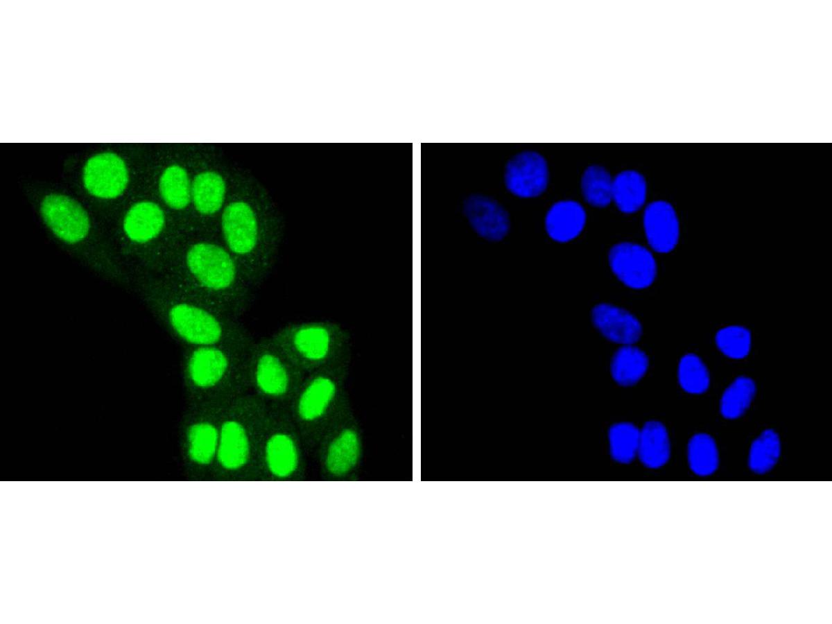 ICC staining of HDAC8 in HepG2 cells (green). Formalin fixed cells were permeabilized with 0.1% Triton X-100 in TBS for 10 minutes at room temperature and blocked with 1% Blocker BSA for 15 minutes at room temperature. Cells were probed with the primary antibody (ET1701-12, 1/50) for 1 hour at room temperature, washed with PBS. Alexa Fluor®488 Goat anti-Rabbit IgG was used as the secondary antibody at 1/1,000 dilution. The nuclear counter stain is DAPI (blue).