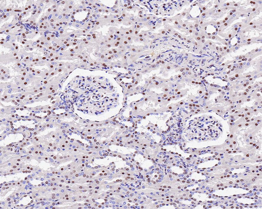 Immunohistochemical analysis of paraffin-embedded human kidney tissue using anti-HDAC8 antibody. The section was pre-treated using heat mediated antigen retrieval with Tris-EDTA buffer (pH 8.0-8.4) for 20 minutes.The tissues were blocked in 5% BSA for 30 minutes at room temperature, washed with ddH2O and PBS, and then probed with the primary antibody (ET1701-12, 1/50) for 30 minutes at room temperature. The detection was performed using an HRP conjugated compact polymer system. DAB was used as the chromogen. Tissues were counterstained with hematoxylin and mounted with DPX.